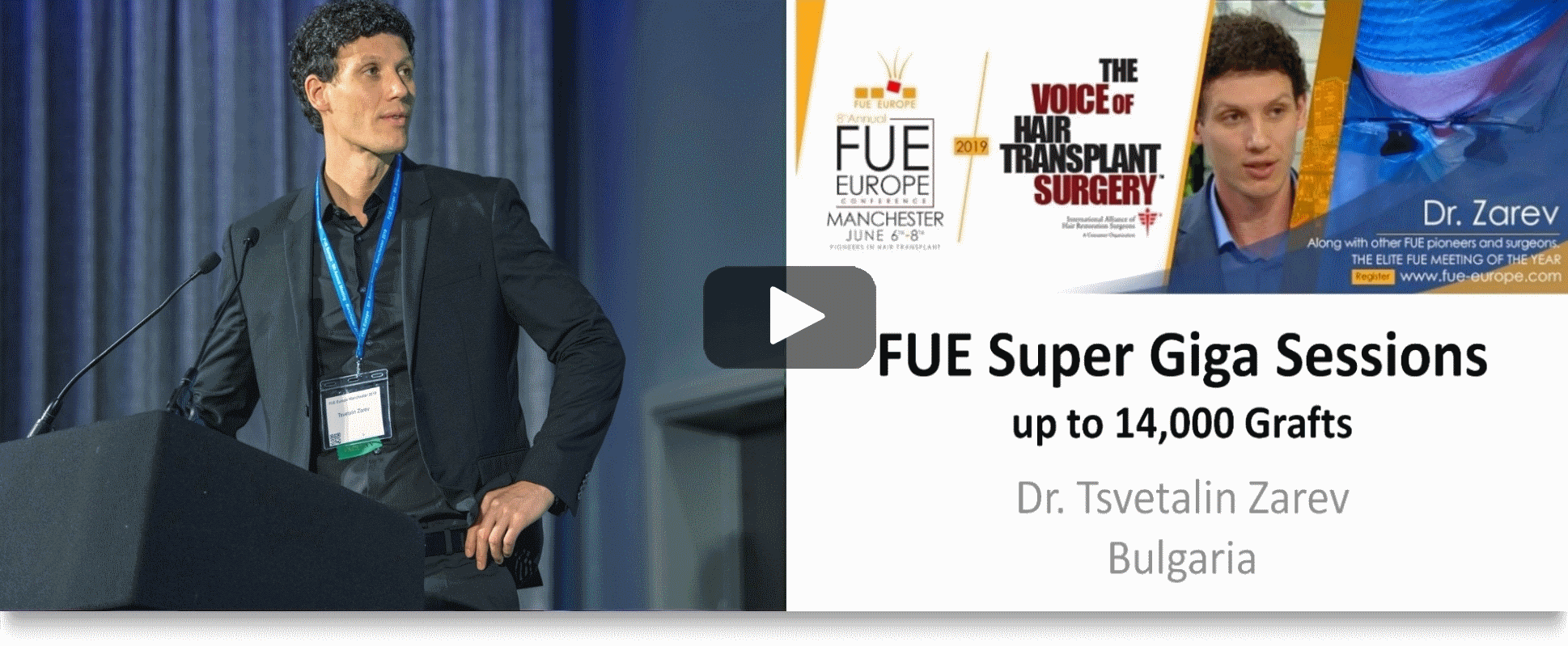 Dr. Zarev FUE Super Giga Sessions 14000 Grafts