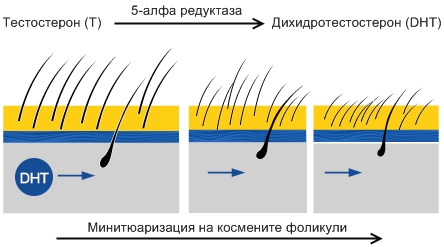 Косопад при мъже космени фоликули